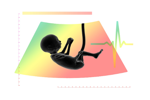 ultrasound-fetus-embryo-placenta-4536369