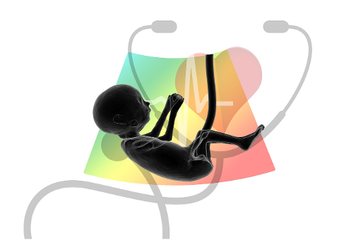 ultrasound-fetus-embryo-placenta-4536367