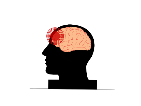 headache-brain-head-trauma-injury-7228961