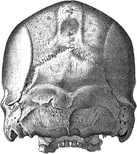 skull-head-cranium-bones-skeleton-8135245