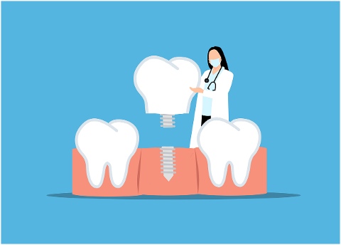 dental-implant-oral-health-medical-8444852